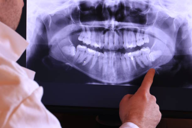 Best Urgent Dental Care for Toothache in Bloomington, TX
