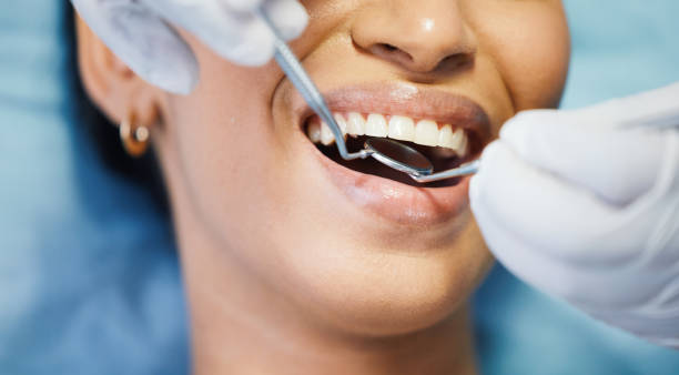 Best Emergency Dental Extractions in Bloomington, TX