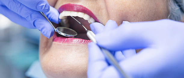 Best Emergency Dental Services for Seniors in Bloomington, TX